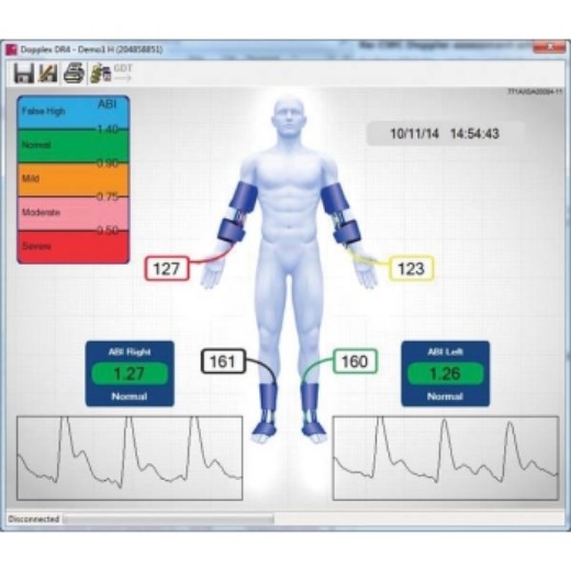 Picture of Dopplex Reporter Software Package