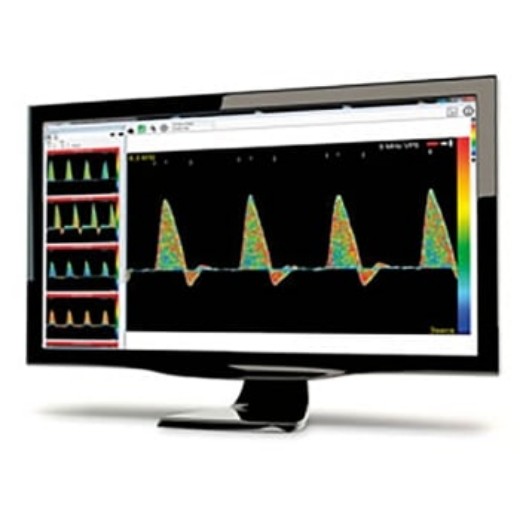 Picture of Huntleigh Dopplex DR5 Lite Reporting Software