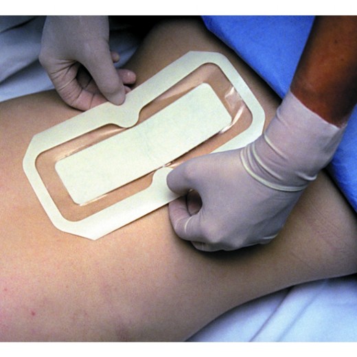 Picture of 3M Tegaderm + Pad Film Island Dressing Waterproof With Non-Adherent Pad 5 X 7cm