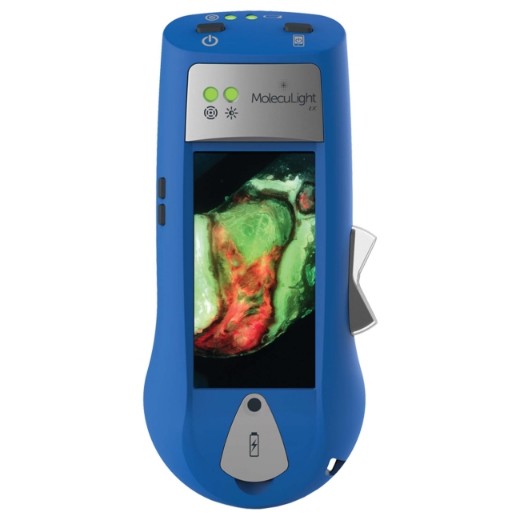 Picture of MolecuLight I:X Wound Imaging Device