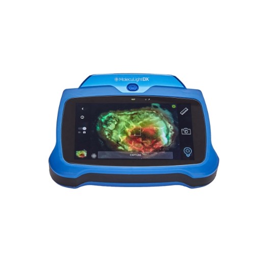 Picture of MolecuLightDX Wound Imaging Device
