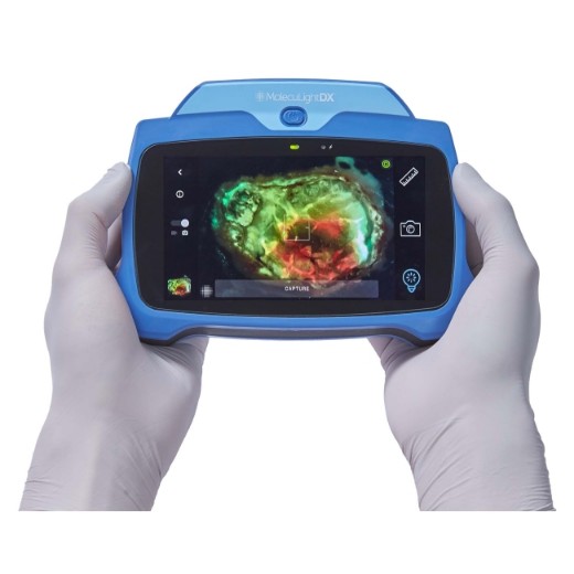 Picture of MolecuLightDX Wound Imaging Device