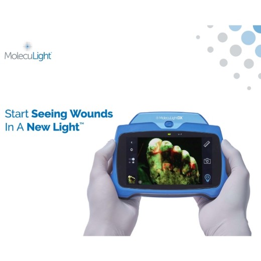 Picture of MolecuLightDX Wound Imaging Device