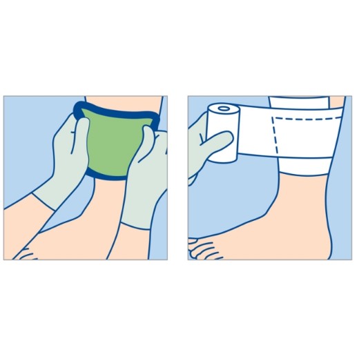 Picture of Zetuvit Plus Sterile 20 X 40cm
