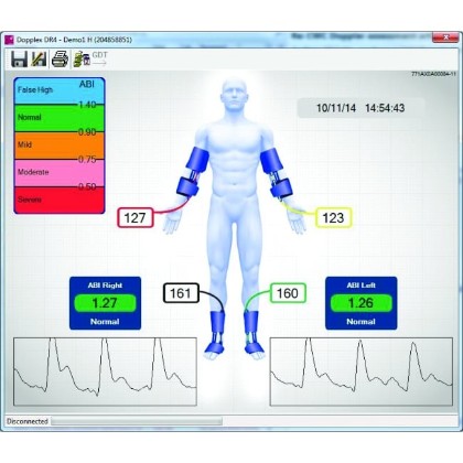 Picture of Huntleigh Dopplex Ability Doppler EABI