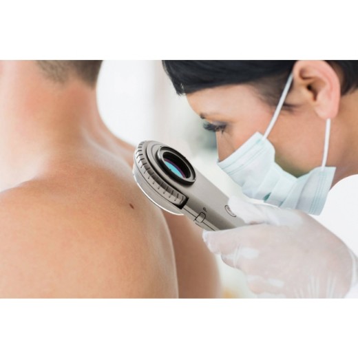 Picture of Illuco IDS-1100 Dermatoscope