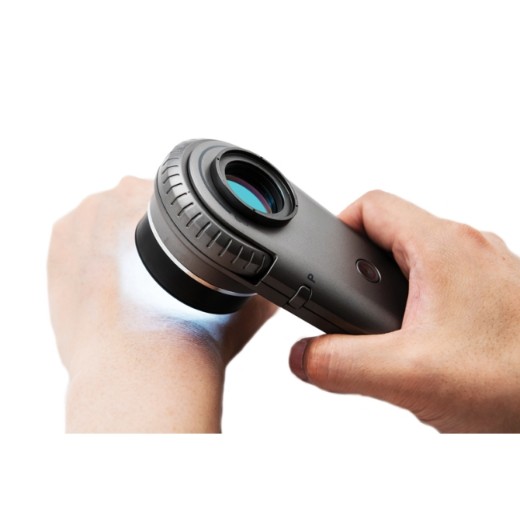 Picture of Illuco IDS-1100 Dermatoscope