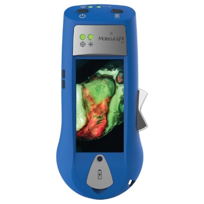 Picture of MolecuLight I:X Wound Imaging Device