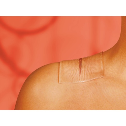 Picture of Cica-Care 12 X 6cm Adhesive Silicone Sheet Dressing